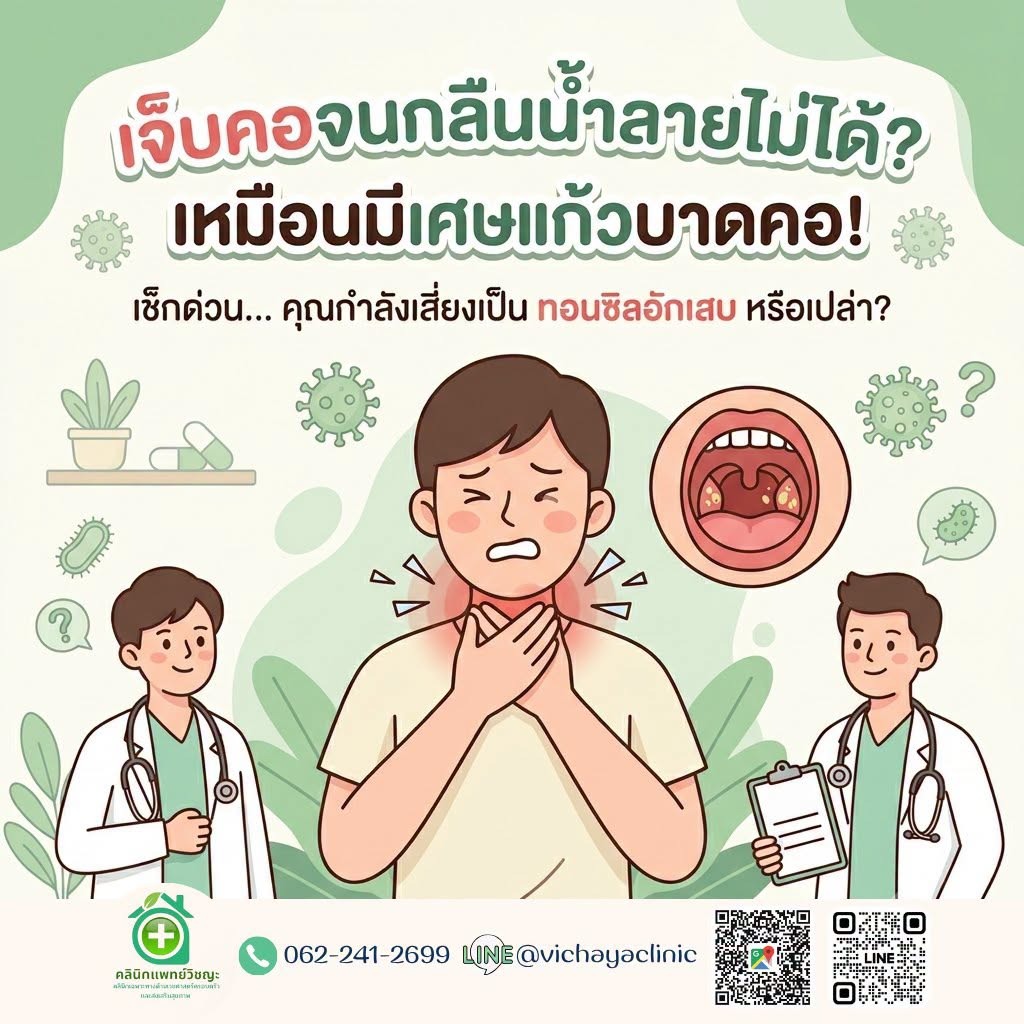 เจ็บคอจนกลืนน้ำลายไม่ได้ เหมือนมีเศษแก้วบาดคอ เช็กสัญญาณเตือนโรคต่อมทอนซิลอักเสบ ทอนซิลเป็นหนอง ทอมซิลอักเสบ รักษาตรงจุดโดยคลินิกแพทย์วิชญะ หาดใหญ่ สงขลา